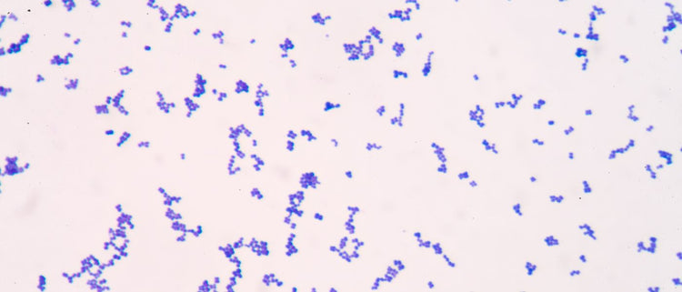 Blog of Reduce Gut Fermentation for SIBO Relief: Introducing the Prebiotic Bacteriophage which have image bacteriophages
